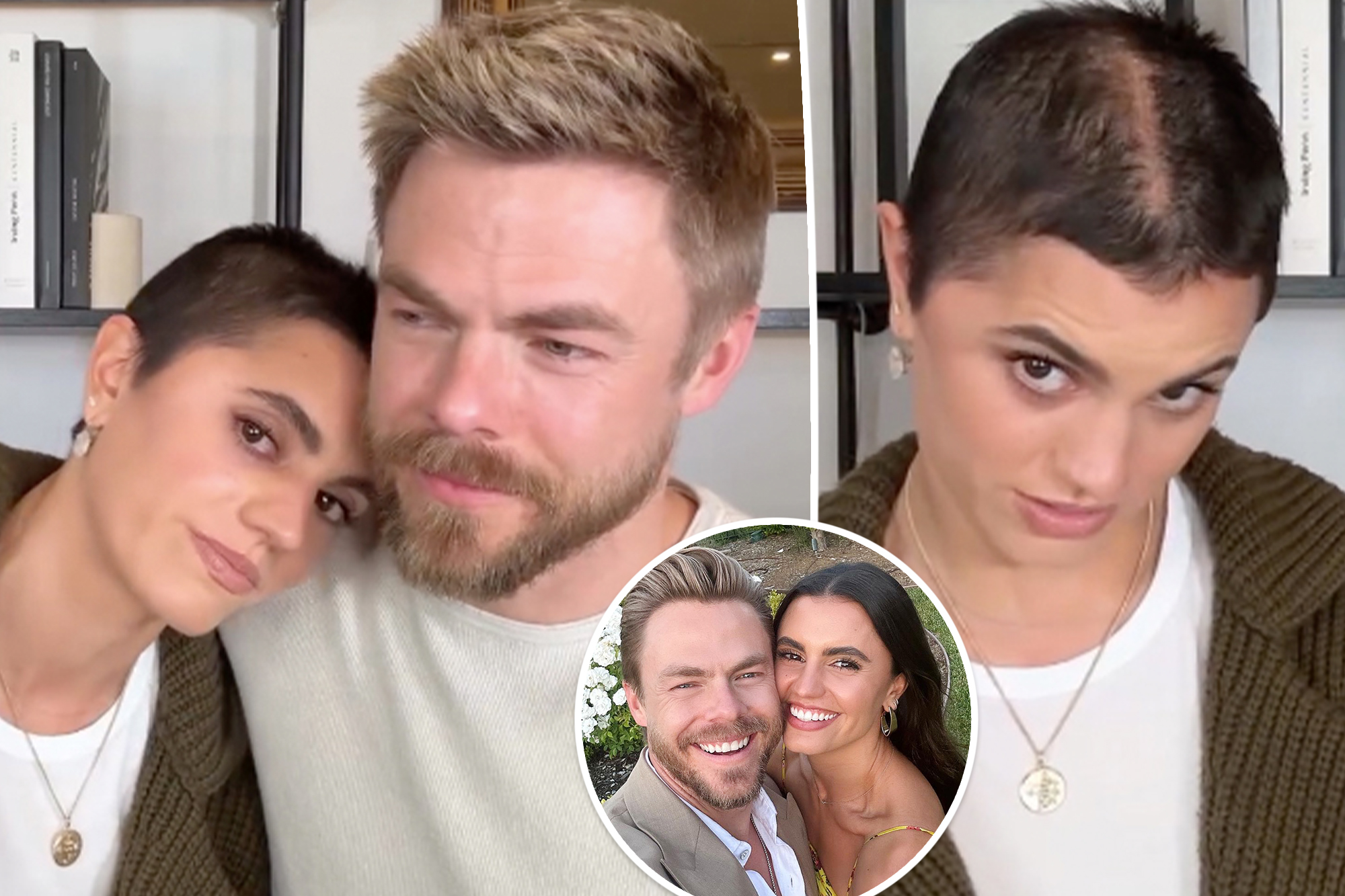 Derek Hough’s spouse, Hayley Erbert, reveals new haircut, head scar after mind surgical procedures