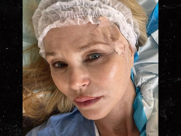 Christie Brinkley Reveals Pores and skin Most cancers Prognosis, Shares Surgical procedure Images