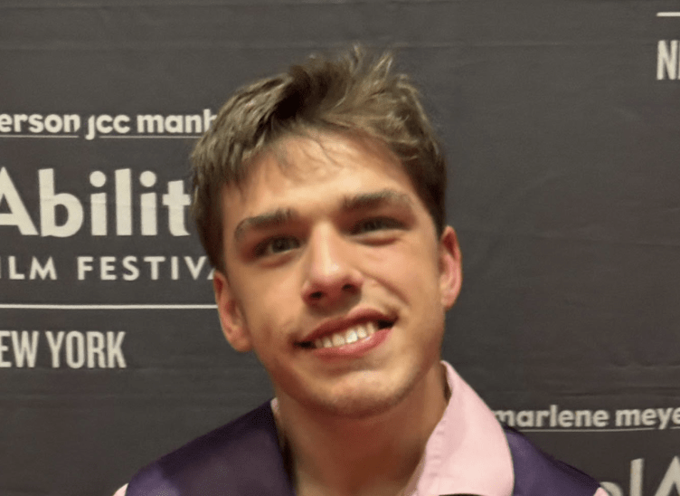 More Than a TikTok Star: Toby Smiles’ Journey of Strength and Self-acceptance