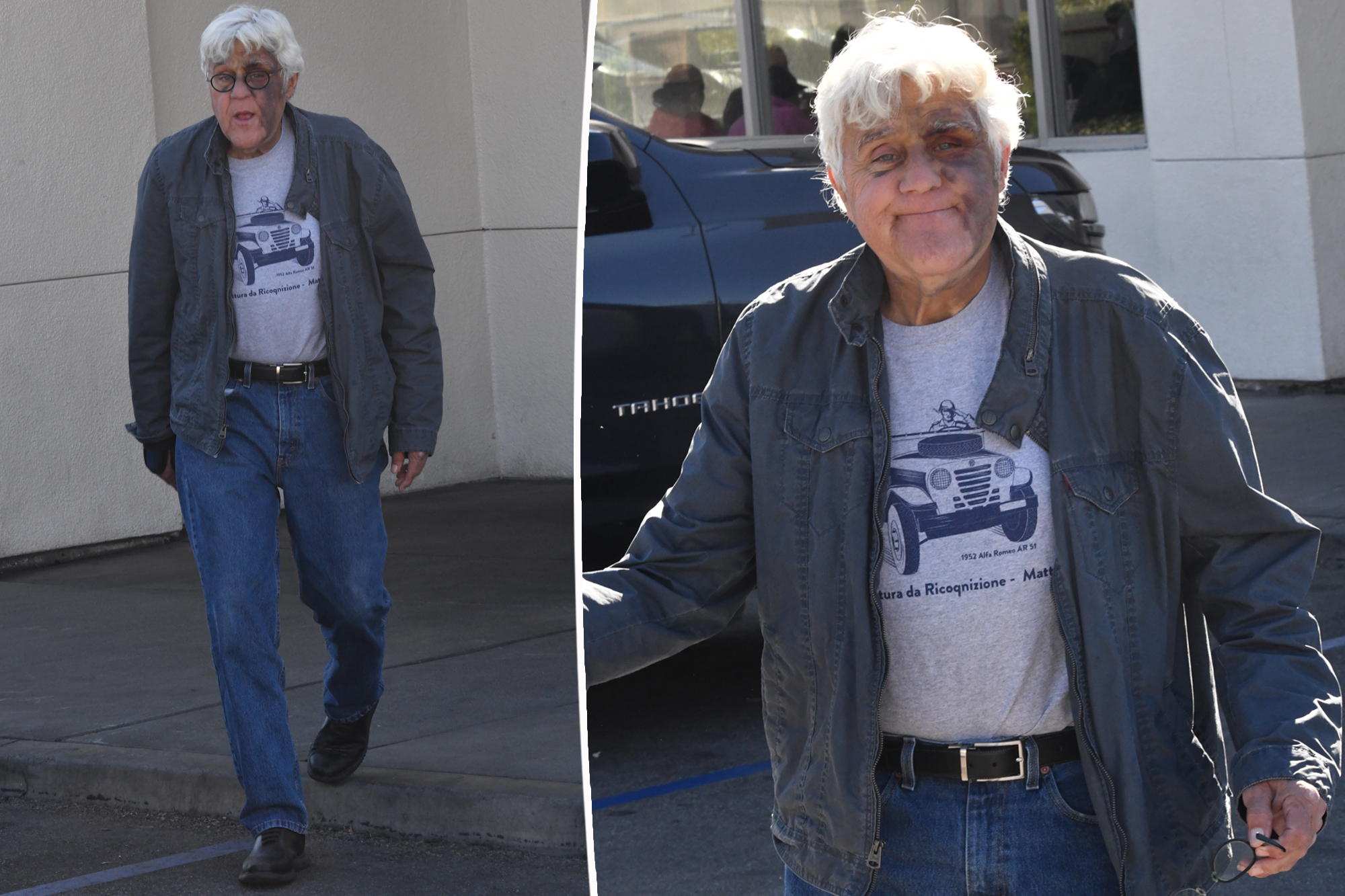 Jay Leno seems in good spirits regardless of large nasty bruise from falling down a hill