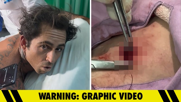 Browsing Star Billy Kemper Gashed By Board, Exhibits Gnarly Damage