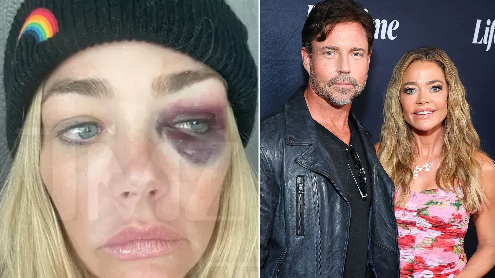 All of the Alleged Abuse Denise Richards Detailed In Aaron Phypers Restraining Order Docs