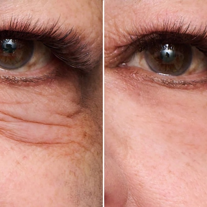 Restock! Peter Thomas Roth’s Instant FIRMx Eye Temporary Eye Tightener