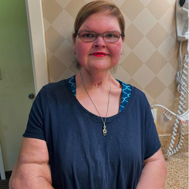 1000-Lb. Sisters’ Tammy Slaton Responds to Concern Over Facial Bruising