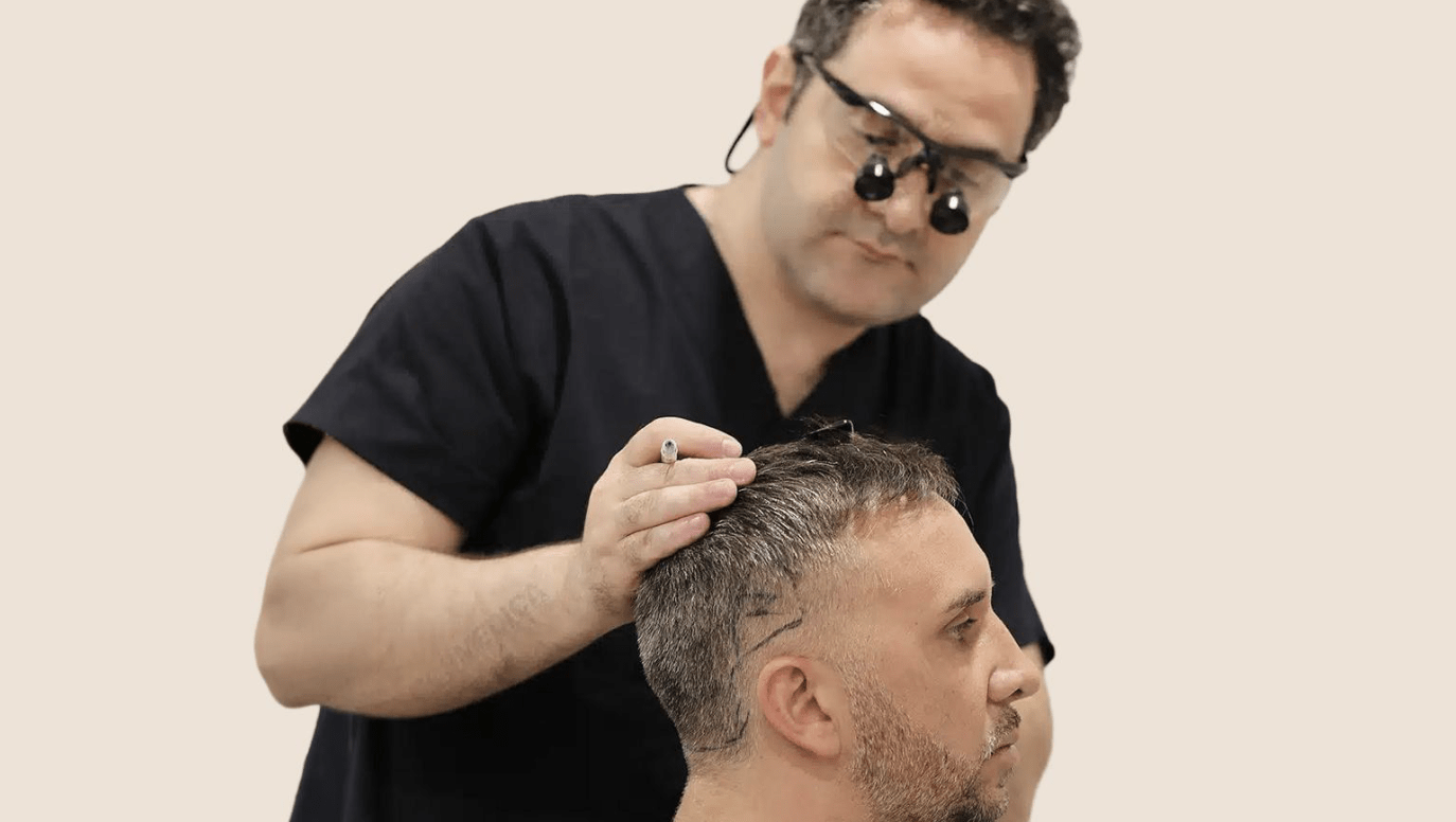 Looking for the Best Hair Transplant in Turkey: How to Choose the Right Clinic