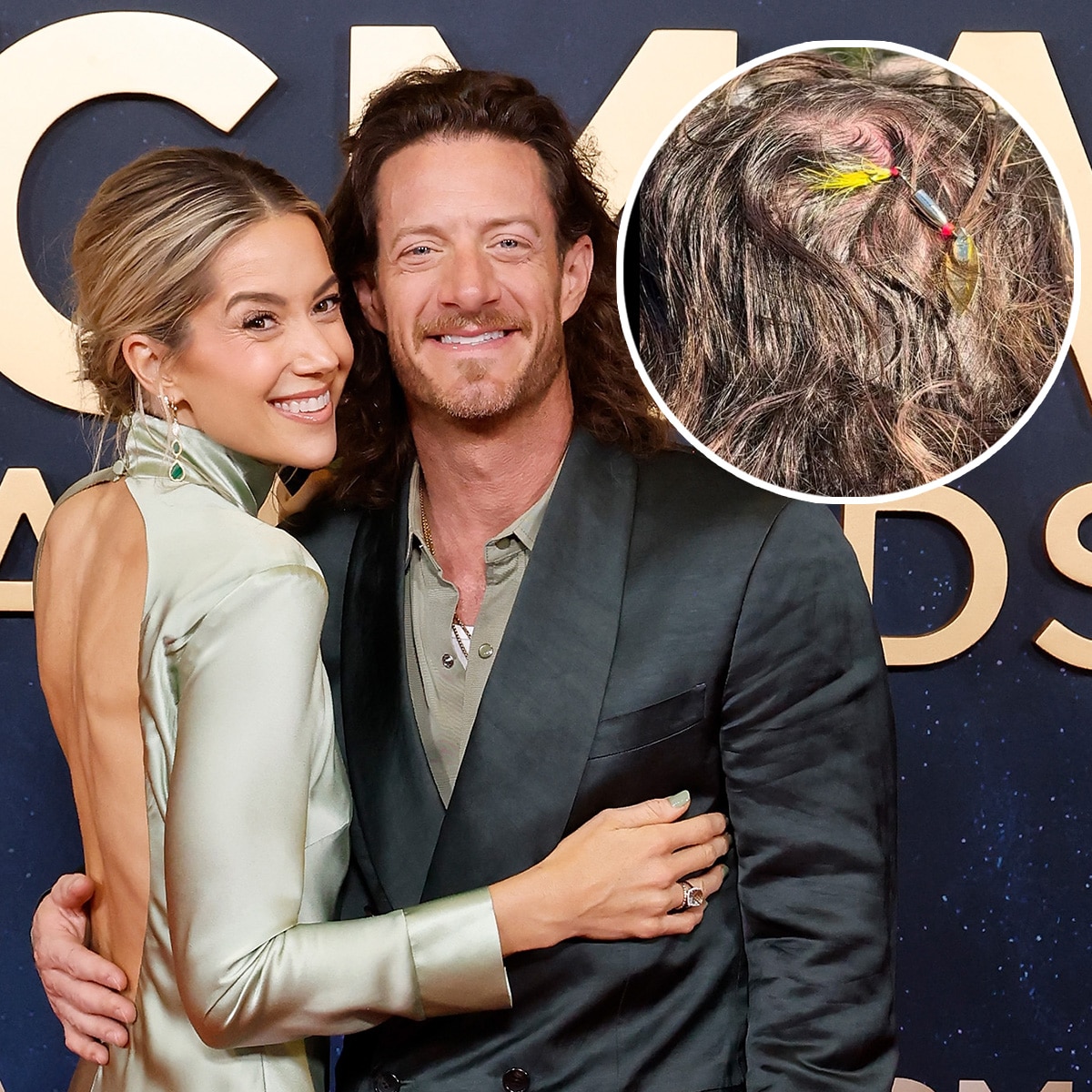 Florida Georgia Line’s Tyler Hubbard Gets Fish Hook Removed From Head