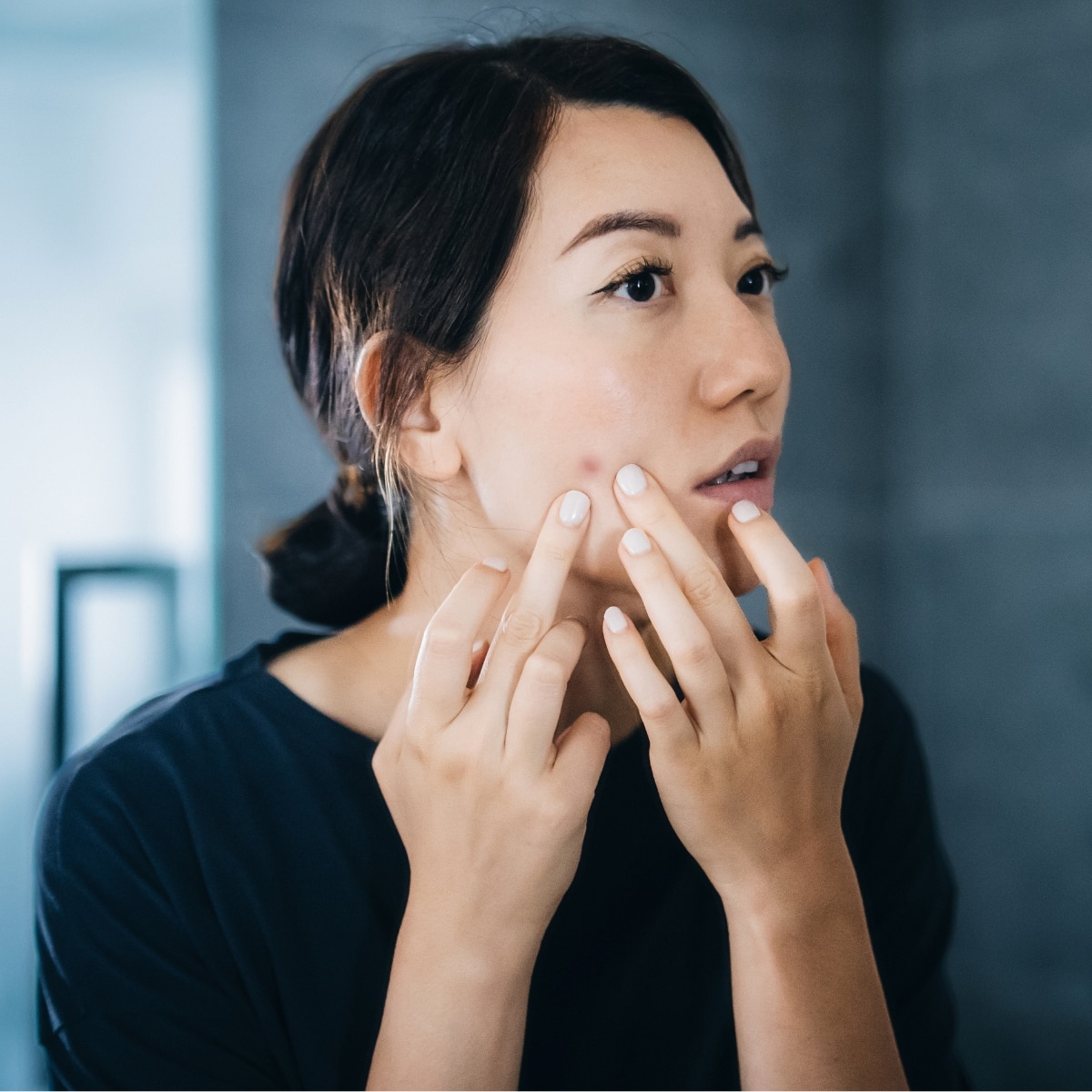 Derm Says Stop Making This Skincare Mistake, It’ll Lead to Summer Acne