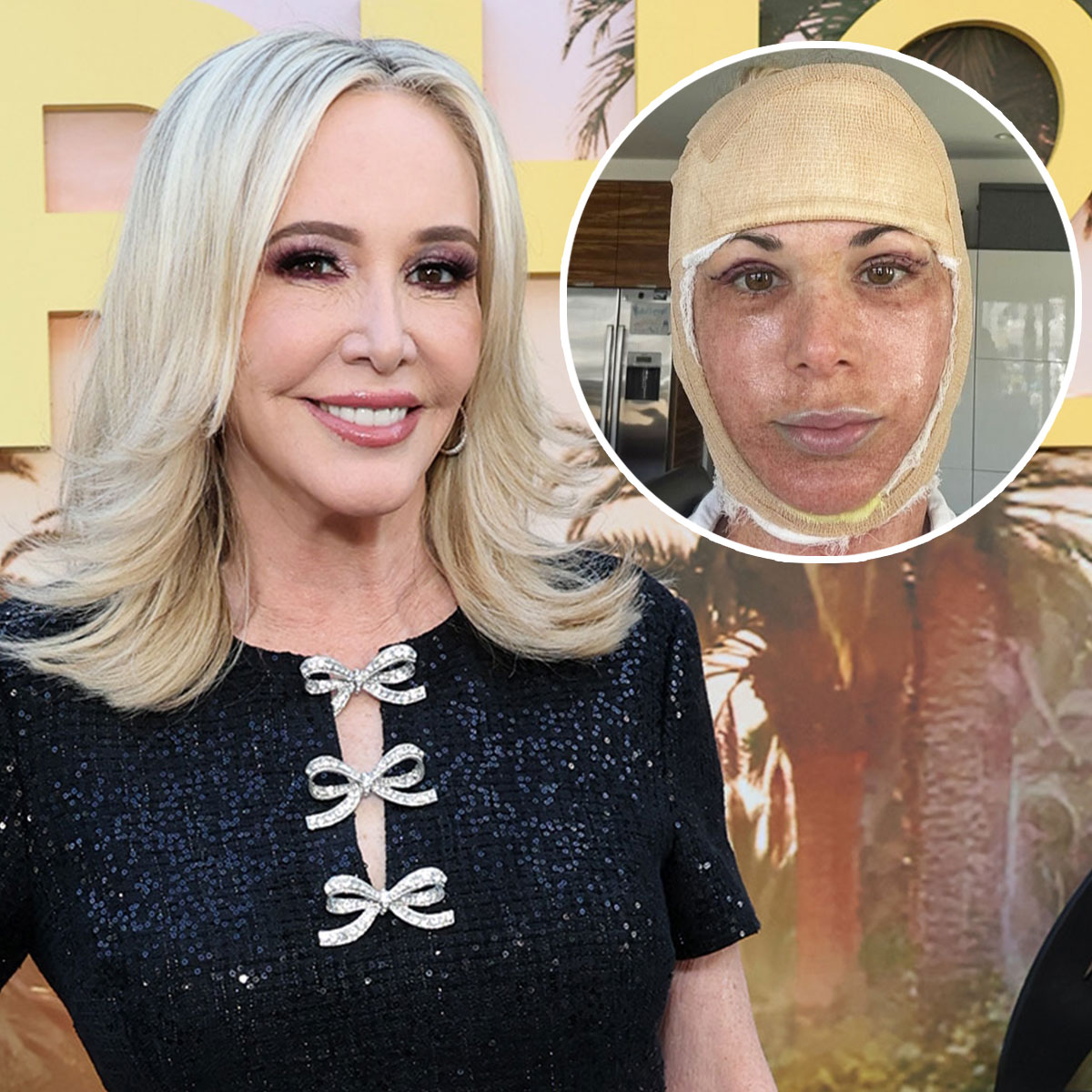 RHOC’s Shannon Beador Shades Alexis Bellino’s Facelift Reveal
