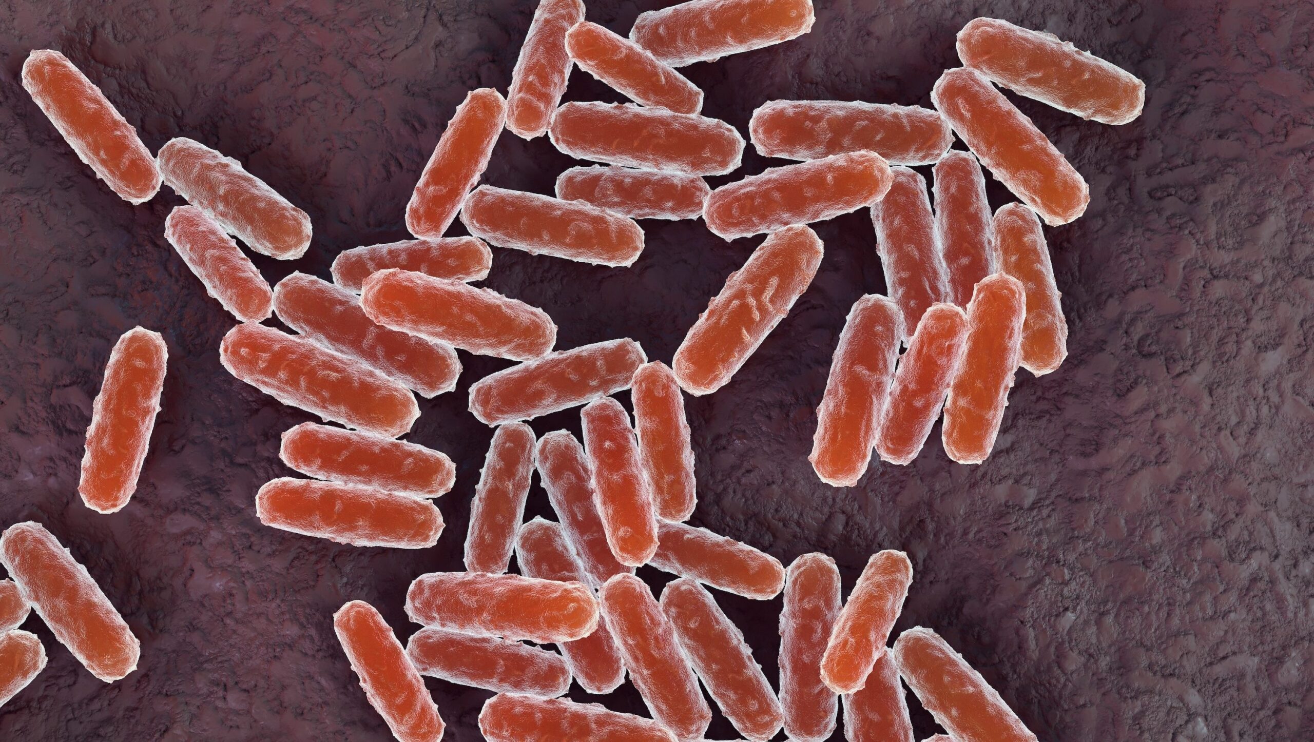 Is Pneumonic Plague in America? What to Know as the Infection Spreads in Russia
